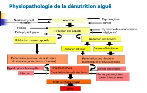 Physiopathologie de la denutrition aiguë Diagnotic de la dénutrition