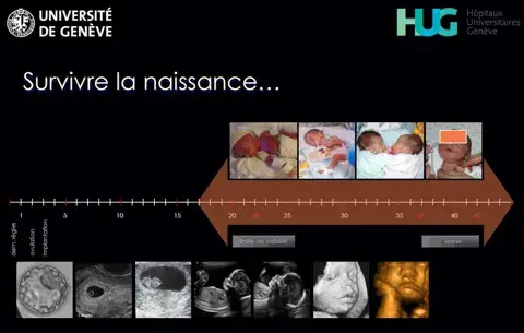 Survivre la naissance Survivre la naissance